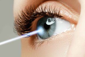 LASIK Eye Surgery