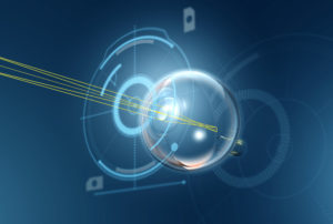 advanced cataract surgery concept graphic